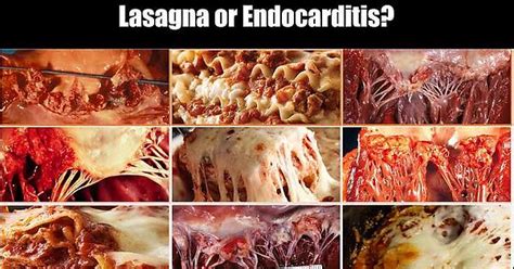 Craving Endocarditis Album On Imgur