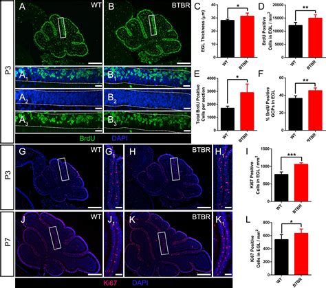 Frontiers Abnormal Cerebellar Development Is Involved In Dystonia