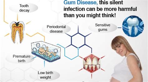 Oral Health Care During Pregnancy