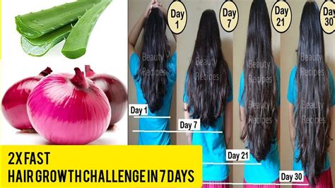 How To Use Onion Juice For Fast Hair Growth Aloe Vera Gel For Hair