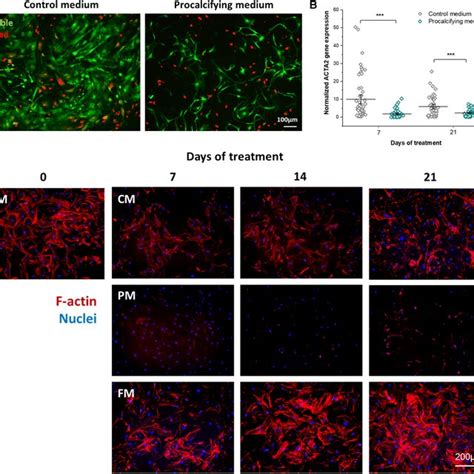 Myofibroblastogenesis Of VICs In PM A Visualization Of Viable