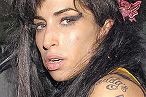 Amy Winehouse Released From Hospital After Suspected Drug Overdose