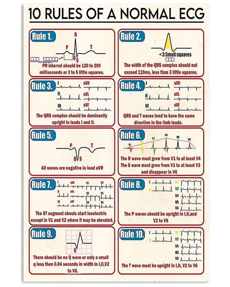10 Rules Of A Normal Ecg Poster Home Decor Wall Art Print T Artofit