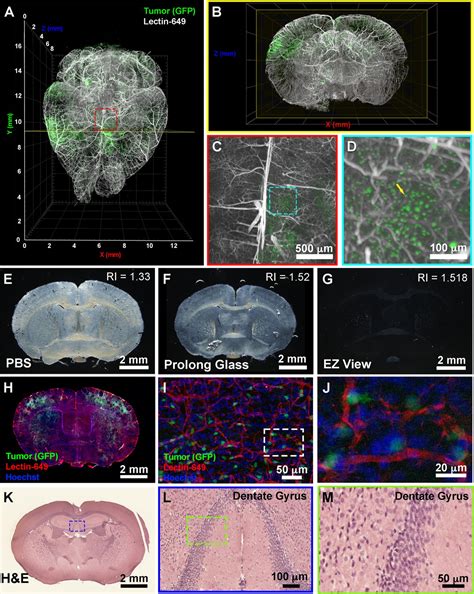 Figures And Data In Ez Clear For Simple Rapid And Robust Mouse Whole