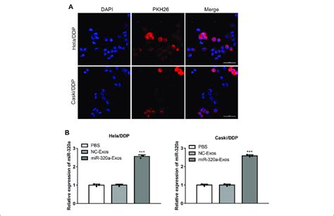 Engineered Mir 320a Exosomes Can Be Effectively Up Taken By Heladdp