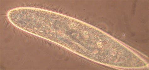 Paramecium Cell Under Microscope