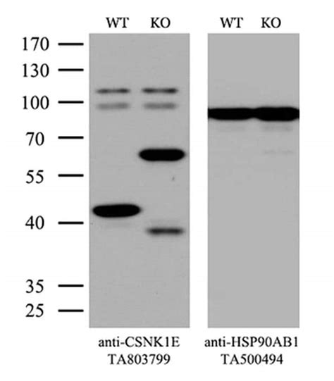 CSNK1E Antibody TA803799