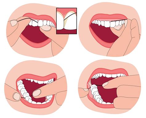 Como usar el hilo dental correctamente Clínica dental Nadal