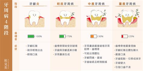 牙周病治療：注意4階段6症狀，拖延不治療小病變大病｜裕見美牙醫診所