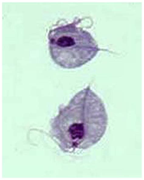 Hiv Insight Trichomoniasis The “neglected” Sexually Transmitted Disease