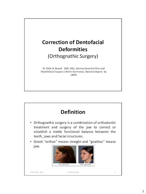 Pdf Correction Of Dentofacial Deformities 1 Correction Of