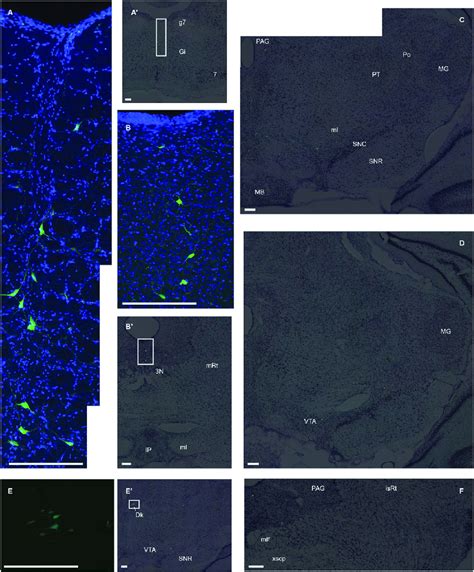 Input Cells From Brainstem A Gfp On Dapi Background Shows Inputs In