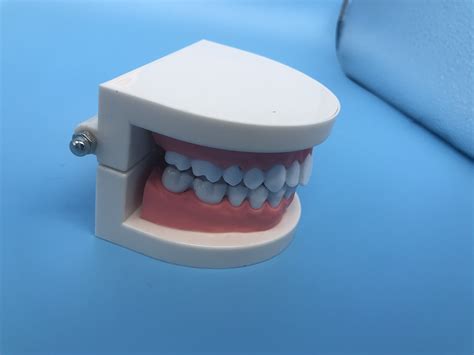 Mod Le D Tude Dentaire Orthodontique Dentaire Pour L Enseignement