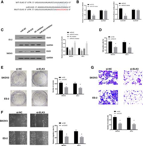 Circular Rna Hsacirc0000144 Aggravates Ovarian Cancer Progression By Regulating Elk3 Via