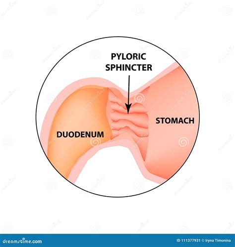 Pylorus Stock Illustrations – 678 Pylorus Stock Illustrations, Vectors & Clipart - Dreamstime