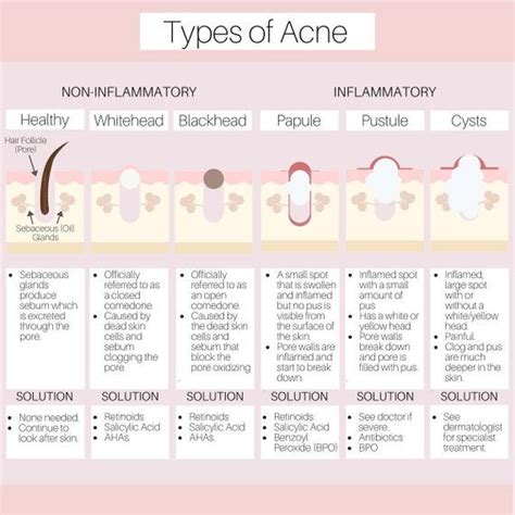 Types of Acne Diagram | Etsy UK | Types of acne, Skin care routine ...