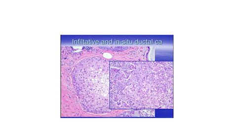 Cytopathology For Beginners Of Cytology Ppt