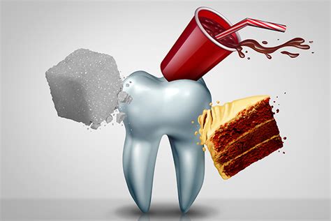 Caries Qu Es C Mo Puedes Prevenirla Y C Mo Se Trata Gaceta Dental