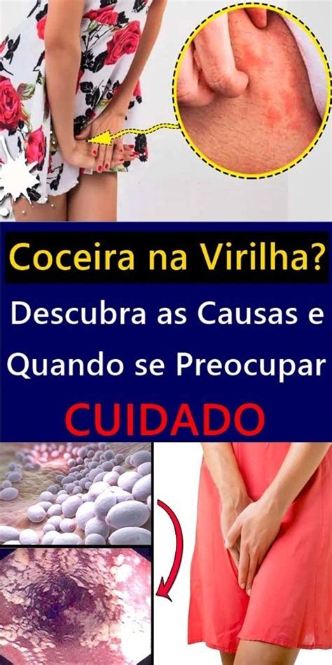 Coceira Na Virilha Descubra As Causas E Quando Se Preocupar