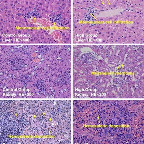 Typical Pathology Of Important Organs In The Histopathological Analysis