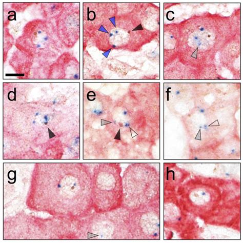 Y Chromosome Containing Hepatocytes In Cross Sex Hematopoietic Stem Download Scientific Diagram