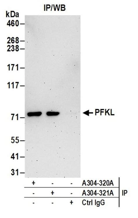 Pfkl Polyclonal Antibody A304 321a