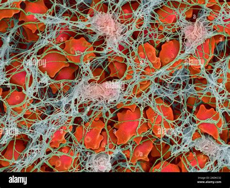 Blood Clot Coloured Scanning Electron Micrograph SEM Of Red Blood