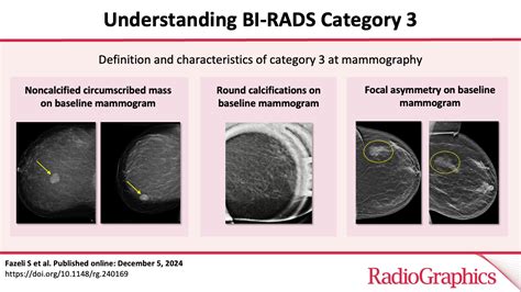 Understanding Bi Rads Category 3 Radiographics