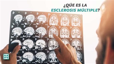 Esclerosis Múltiple La Enfermedad De Las Mil Caras Centro Médico Cervantes