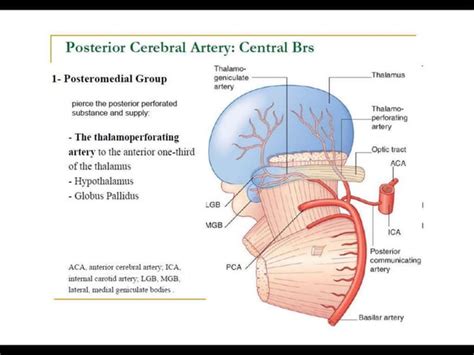 Posterior Circulation Stroke Syndromes Ppt