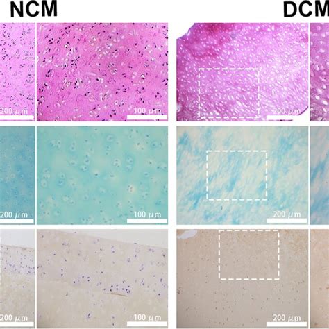 Histological Evaluation Of Cartilage Matrix Before And After