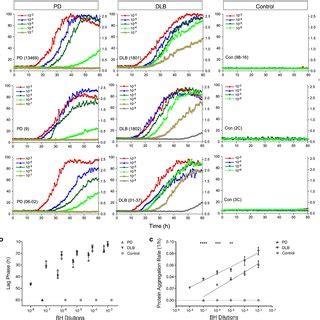 Ultrasensitive Syn Rt Quic Assay Of Csf Samples Of Pd And Dlb A Syn