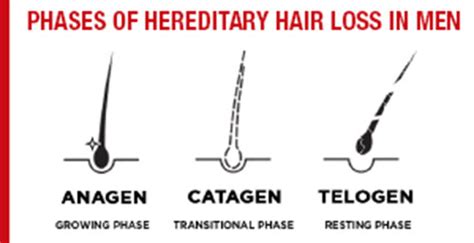 Hereditary Hair Loss In Men Caffeine For Hair Regrowth Alpecin India