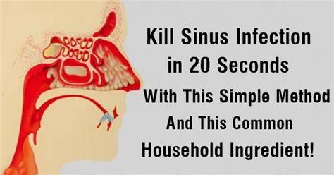 Get Sinus Congestion Relief In 20-Second With This Simple Method