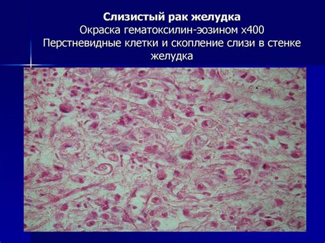 Дистрофии. Классификация - online presentation