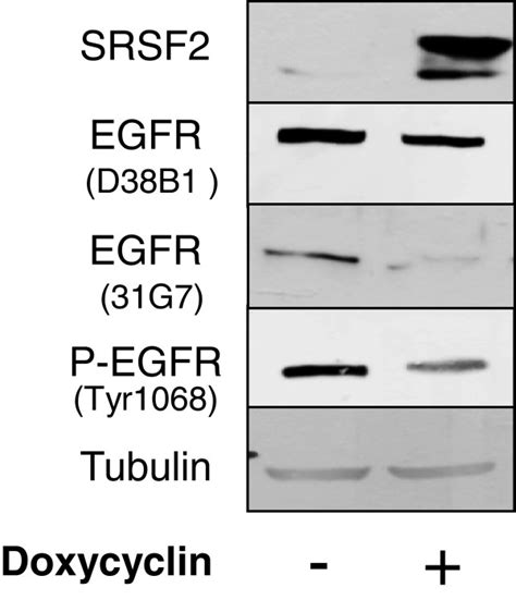 Western Blot Analysis Of Her1egfr Expression Her1egfr And