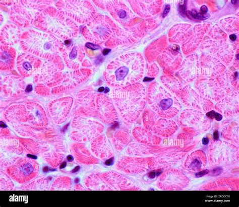 Light Micrograph Of Cross Sectioned Striated Muscle Fibres From Heart