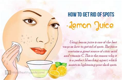 20 Tips How To Get Rid Of Spots On Face Back Legs And Chest Fast