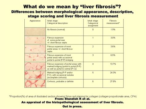 Ppt Fibrosis In The Liver Role Of Histology Is It The Gold Standard Bsg Annual Meeting Post