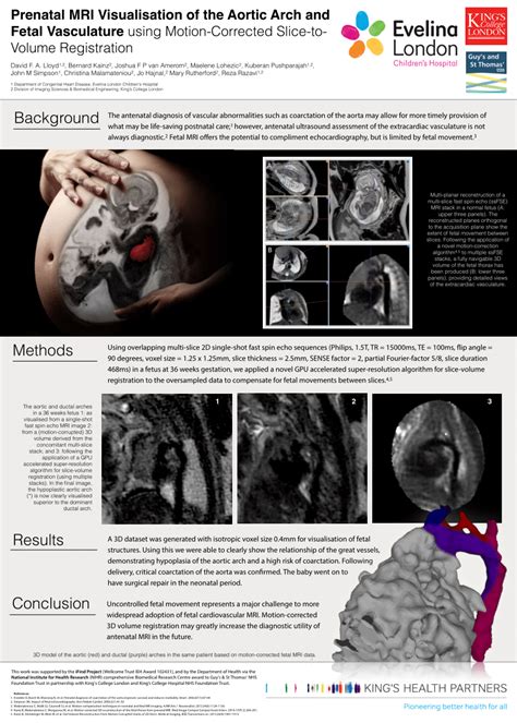 Pdf Prenatal Mri Visualisation Of The Aortic Arch And Fetal