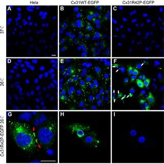 Intracellular Distribution Of Cx31 Variants In Stable Cell Lines Hela