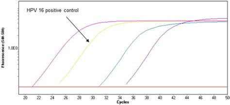 Evaluation And Validation Of Hpv Real Time Pcr Assay For The Detection Of Hpv Dna In Oral