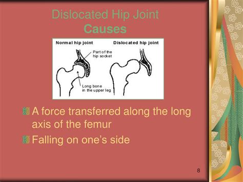 Ppt Injuries Of The Hip And Groin Powerpoint Presentation Free