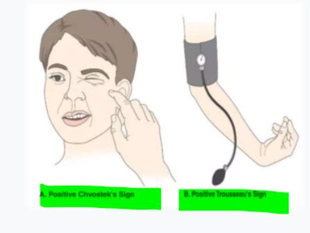 Lecture 8a Clin Med 2 Exam 4 Parathyroid Flashcards Quizlet