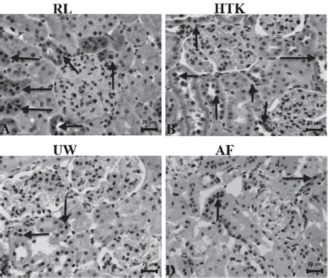 Immunohisto Chemical Staining Of Kidney Tissues By Tunel Showing Rl