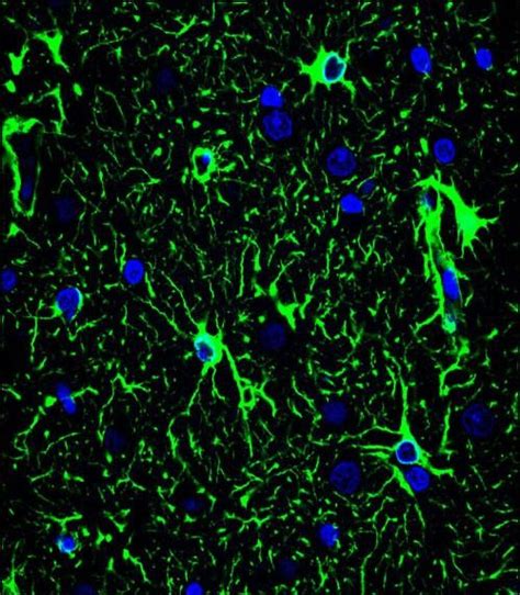 Glial Fibrillary Acidic Protein | GFAP Antibody | Abgent