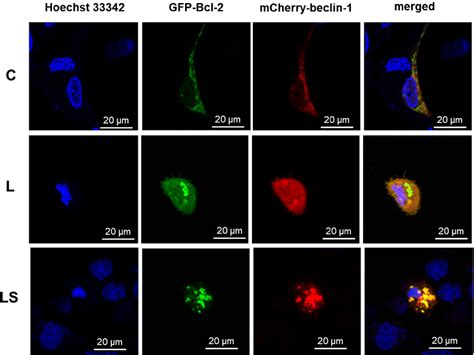 Figure 1 From The Role Of Bcl 2 And Beclin 1 Complex In “switching