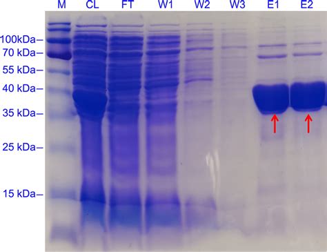 Sds Page Of The Purified His Tagged Bvdr From E Coli Bl Mbvdr