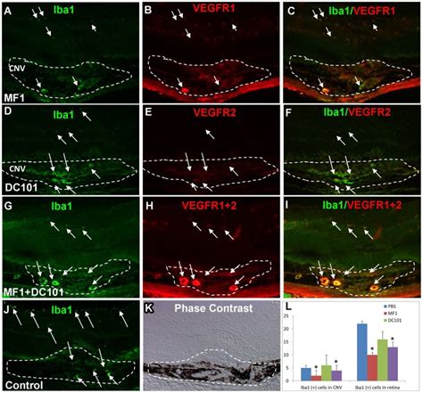 Immunostaining Of Iba Was Performed On Retinal Cryosections Of The