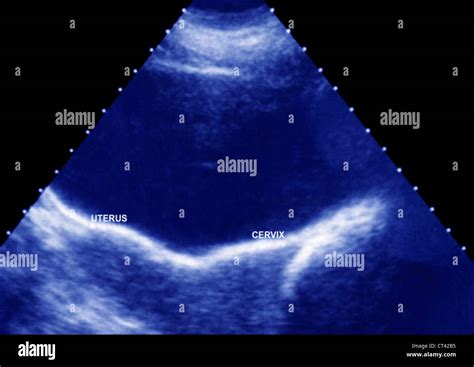 Pelvis Sonography Examination Hi Res Stock Photography And Images Alamy